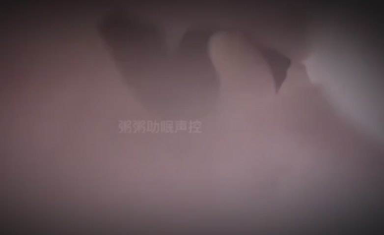 粥粥 高级设备掏耳朵 1V69M百度盘